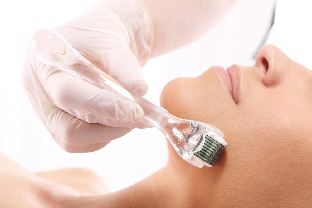 Microneedling with PRP: What's the Famous "Vampire Facial" All About?